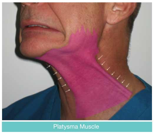 Orlando Facelift Surgery By Dual Board-Certified Surgeon Dr. Yeilding