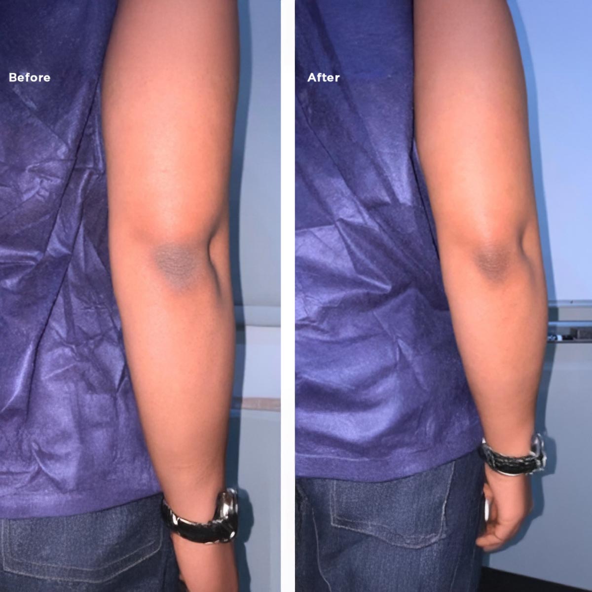 B&A16