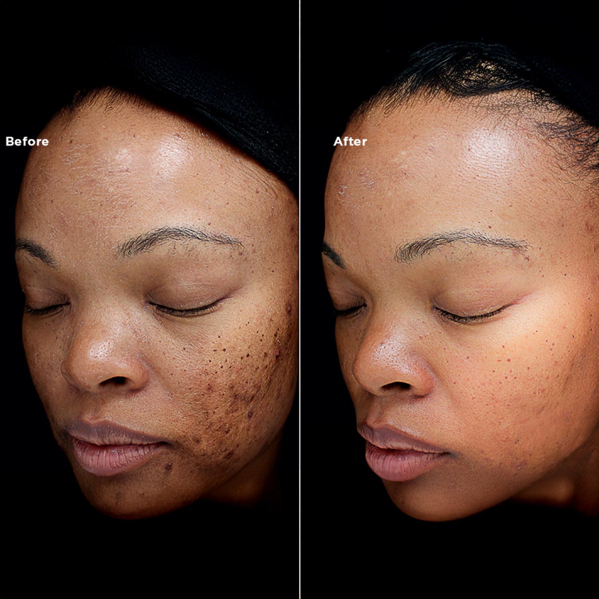 B&A3
