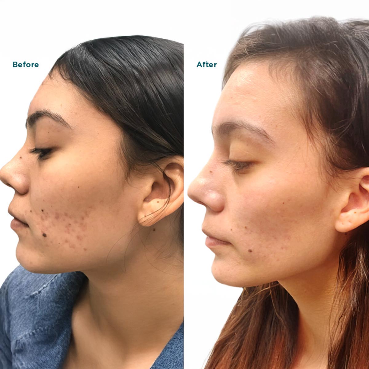 B&A5