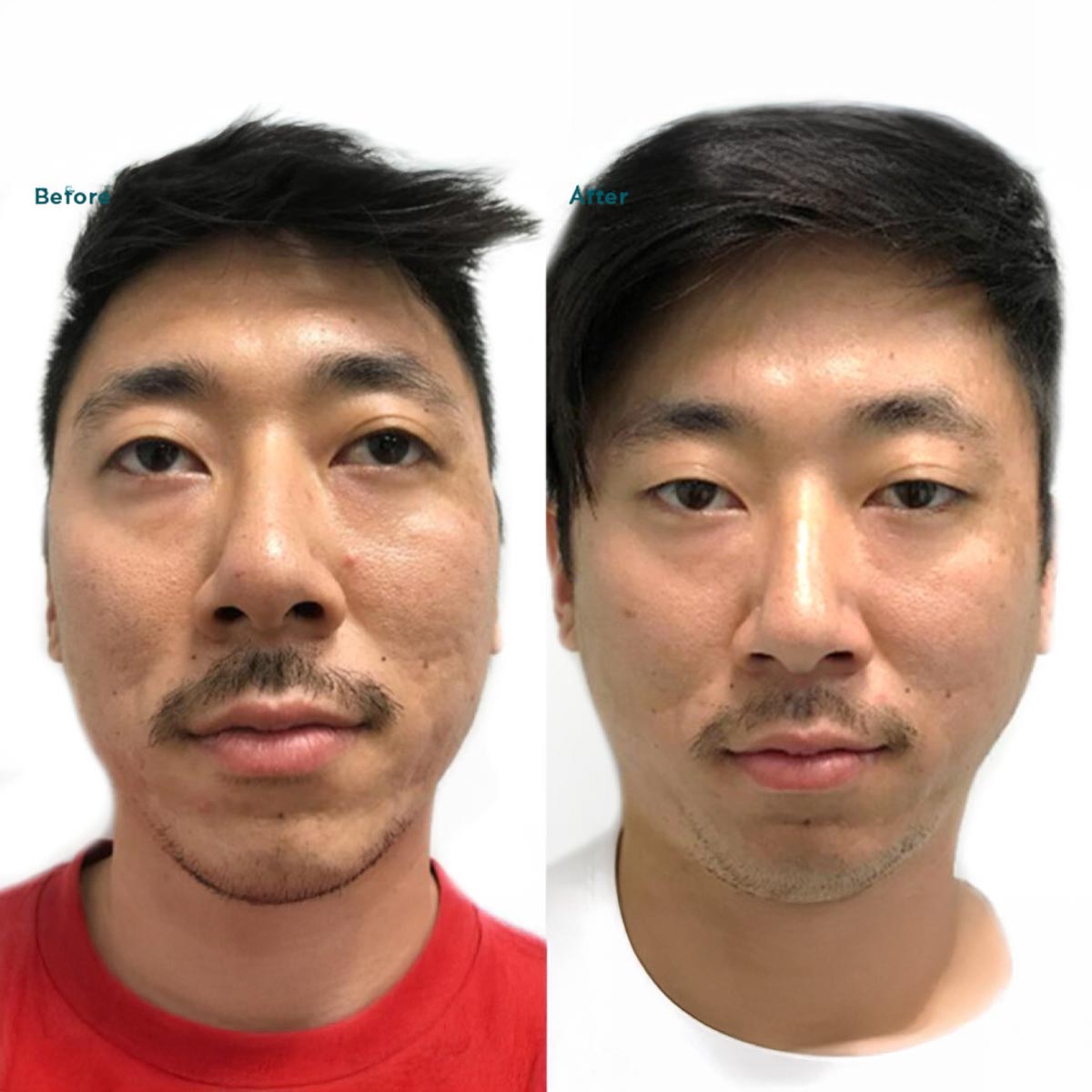 B&A7