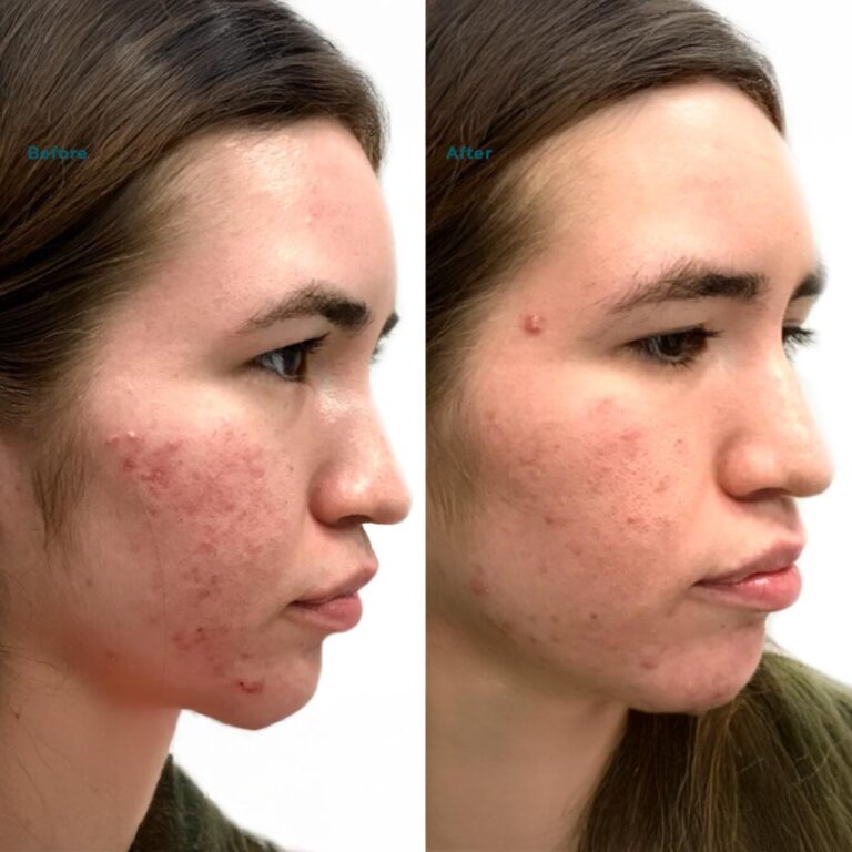 B&A8