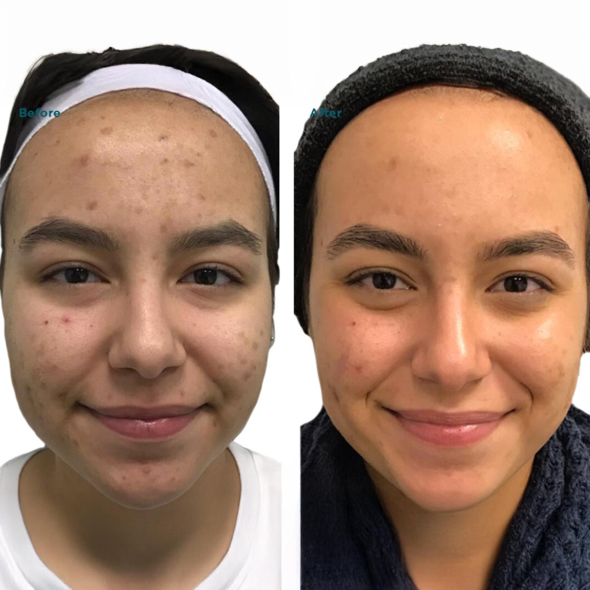 B&A9