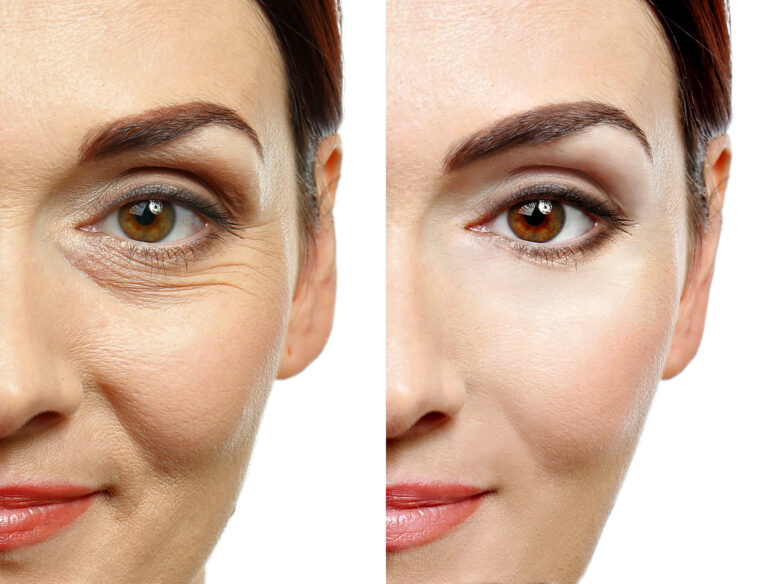 Woman face before and after cosmetic procedure. Plastic surgery concept Image description
