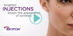 Botox Explainer Video Thumbnail