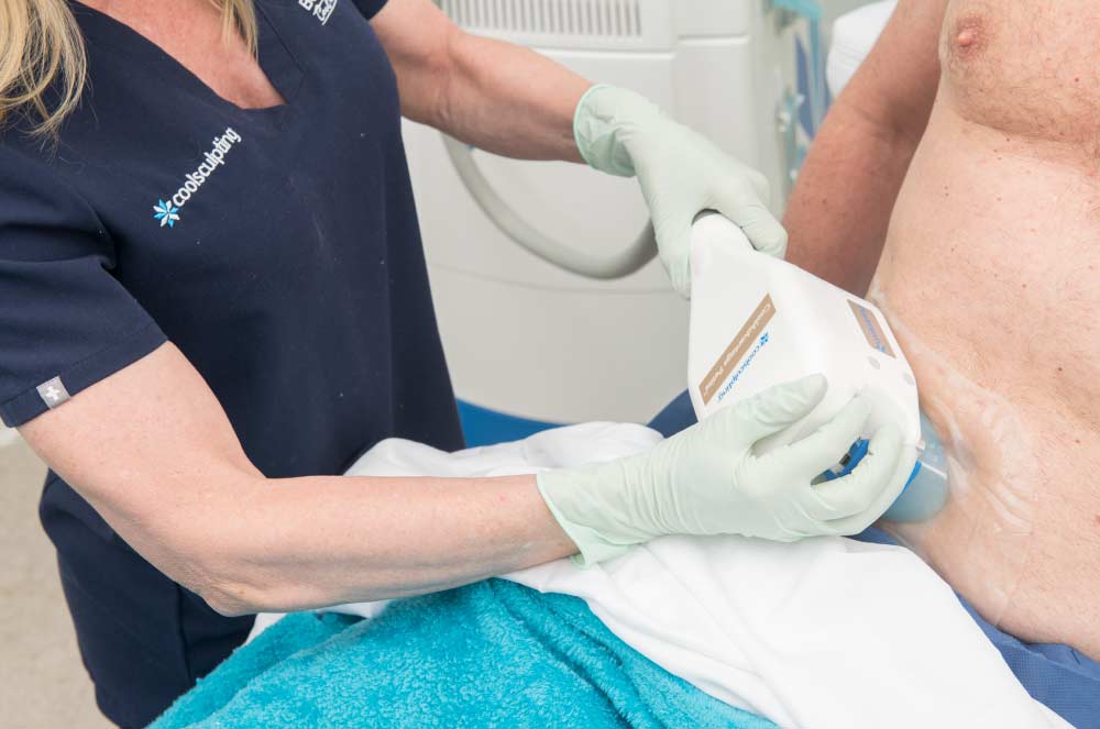 closeup of patient receiving CoolSculpting treatment in the stomach area