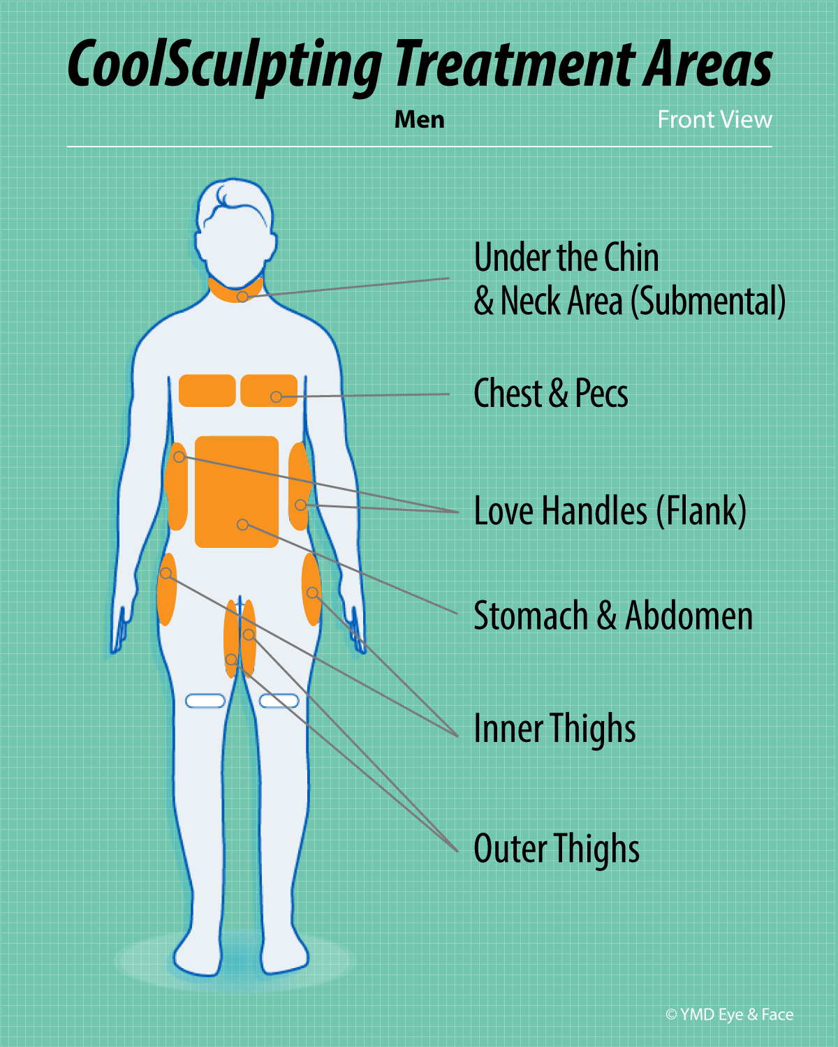 CoolSculpting graphic highlighting possible treatment areas for men (front view): under chin and neck area, chest (pectoral), love handles (flanks), stomach (abdomen), inner and outer thighs