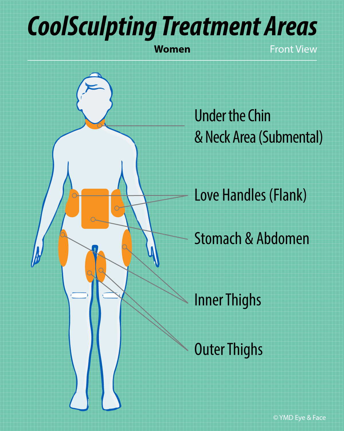 CoolSculpting graphic highlighting possible treatment areas for women (front view): under chin and neck, love handles (flanks), stomach and abdomen, inner thighs and outer thighs