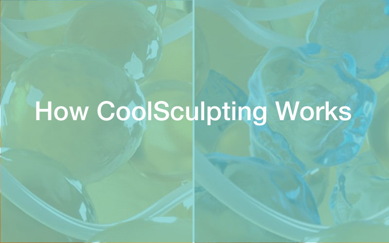 graphic of split image of fat cells with normal fat cells on left and frozen and shrinking fat cells on the right; with text over image: "How CoolSculpting Works"