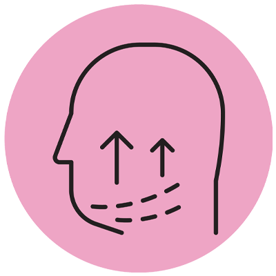 kybella