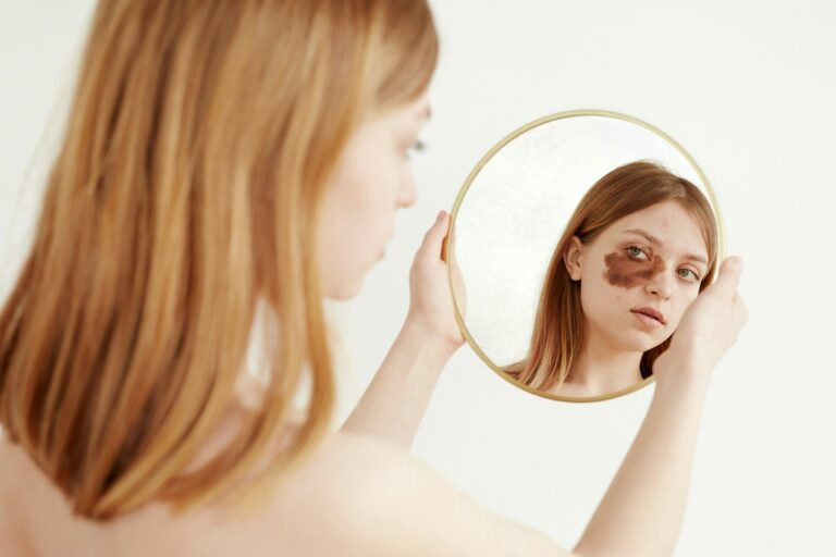 Woman with birthmark on face looking at mirror Image description